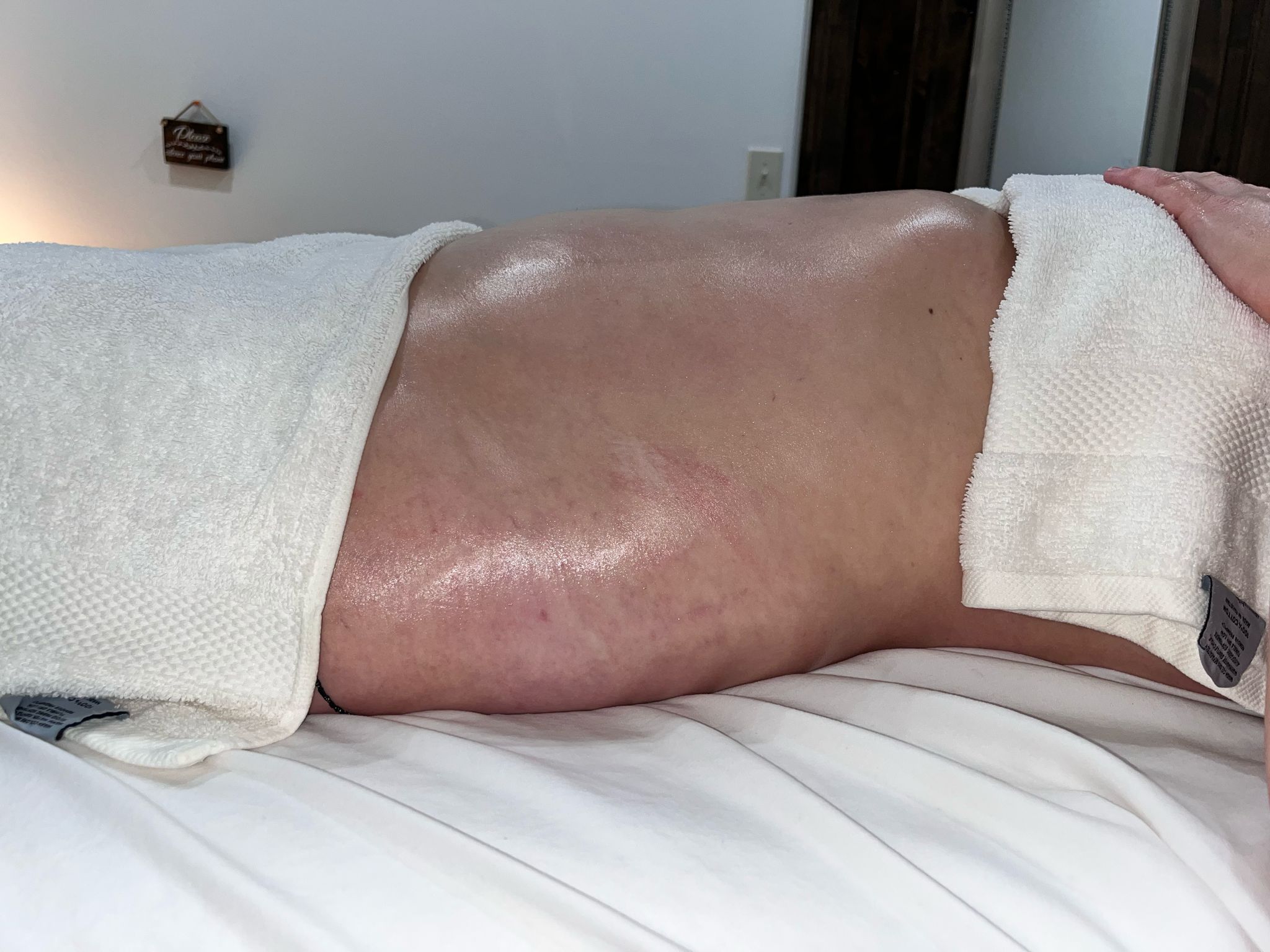 After treatment