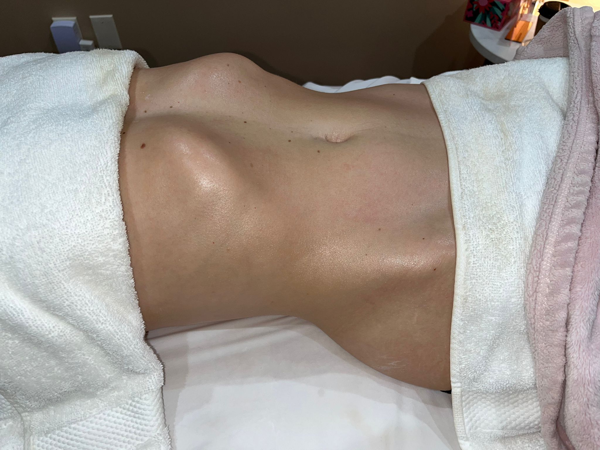 After treatment