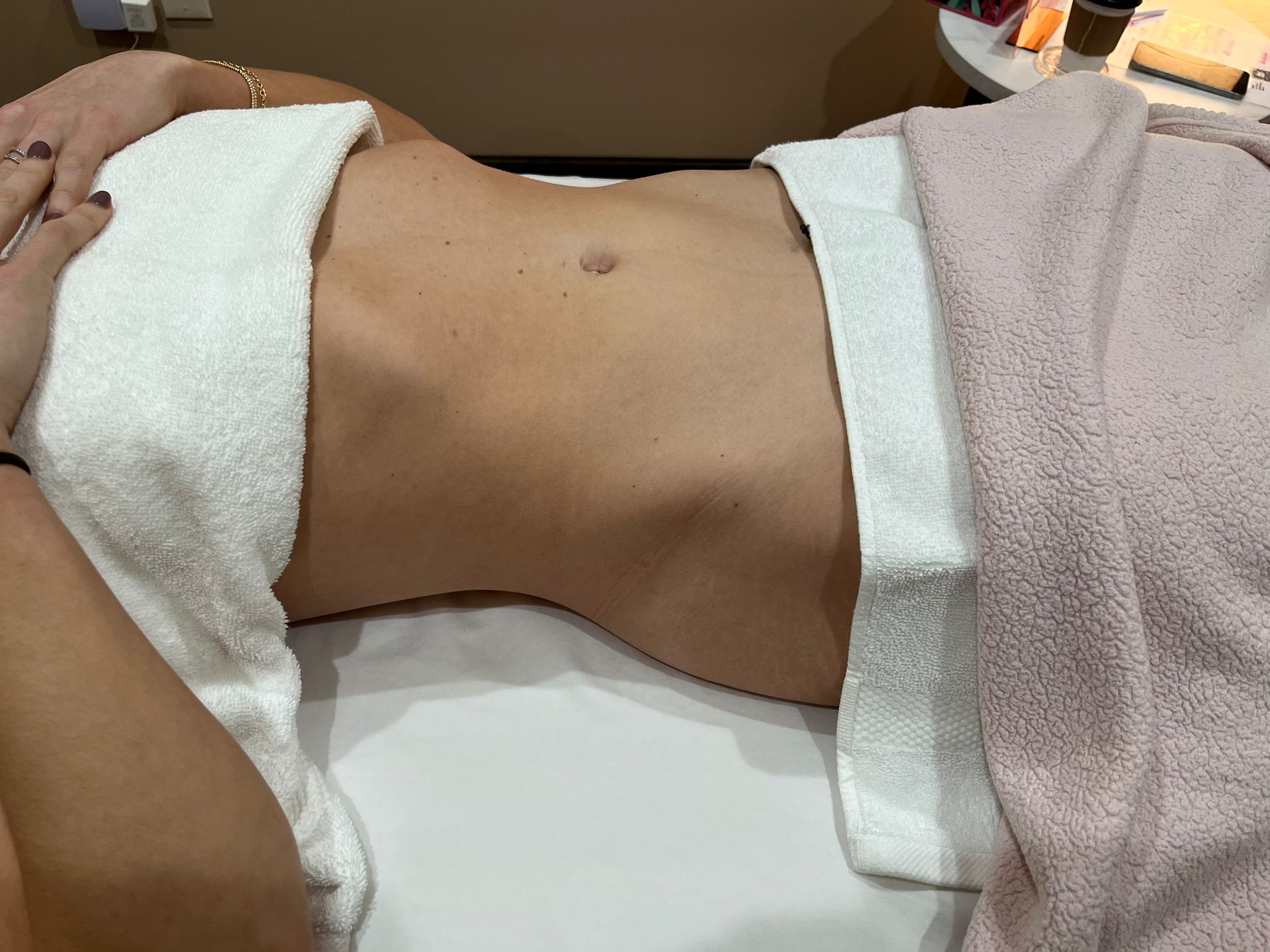 Before treatment